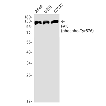 Phospho-FAK (Tyr576) (17X9) Rabbit Monoclonal Antibody | 兔单抗 | EnkiLife恩玑生命