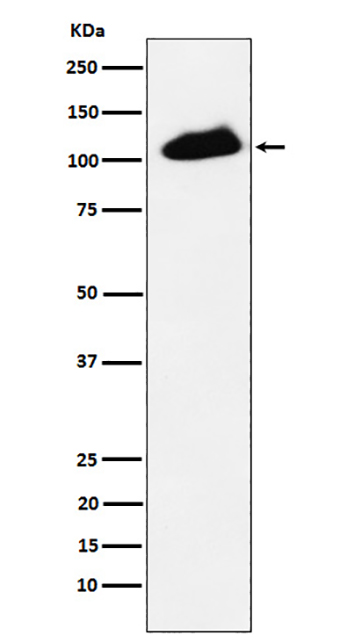 Phospho-KAP1 (S824) (13F9) Rabbit Monoclonal Antibody | 兔单抗 | EnkiLife恩玑生命