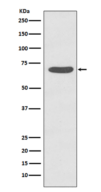 Phospho-PKC zeta (T560) (14P10) Rabbit Monoclonal Antibody | 兔单抗 | EnkiLife恩玑生命