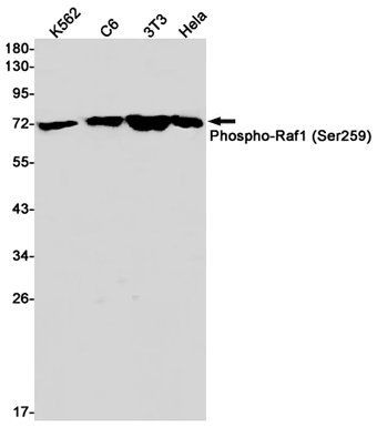 Phospho-Raf1 (Ser259) (4T6) Rabbit Monoclonal Antibody | 兔单抗 | EnkiLife恩玑生命