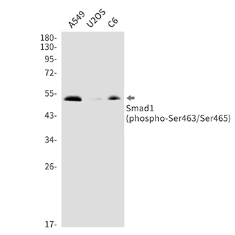 Phospho-Smad1 (Ser463/Ser465) (13F8) Rabbit Monoclonal Antibody | 兔单抗 | EnkiLife恩玑生命