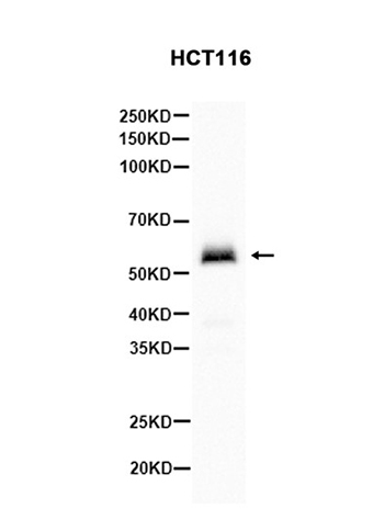 Phospho-Smad1 (Ser463/Ser465) (13F8) Rabbit Monoclonal Antibody | 兔单抗 | EnkiLife恩玑生命