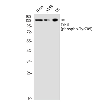 Phospho-TrkB (Tyr705) (3T18) Rabbit Monoclonal Antibody | 兔单抗 | EnkiLife恩玑生命
