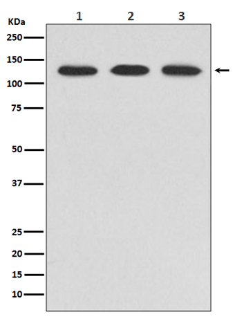 ABL2 (7J9) Rabbit Monoclonal Antibody | 兔单抗 | EnkiLife恩玑生命