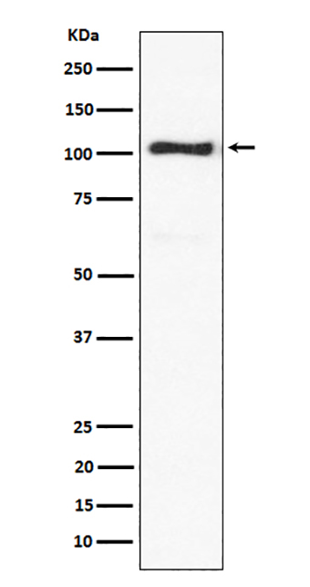 ACTN3 (19N12) Rabbit Monoclonal Antibody | 兔单抗 | EnkiLife恩玑生命