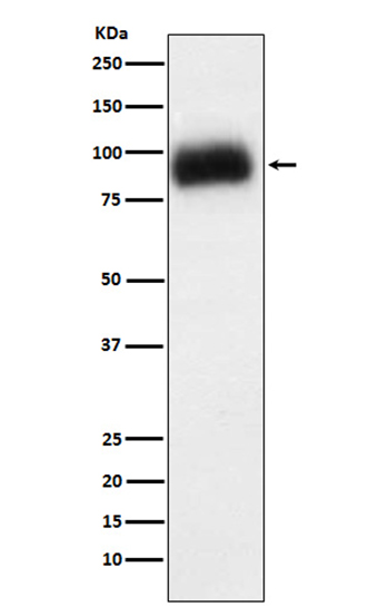 ADAM15 (11M11) Rabbit Monoclonal Antibody | 兔单抗 | EnkiLife恩玑生命