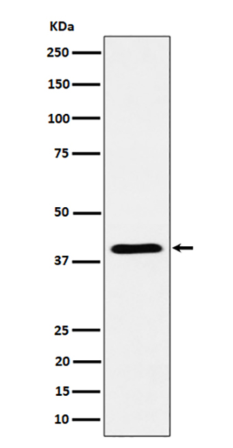 ADH4 (17T19) Rabbit Monoclonal Antibody | 兔单抗 | EnkiLife恩玑生命