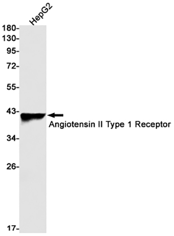 AGTR1  (15Y4) Rabbit Monoclonal Antibody | 兔单抗 | EnkiLife恩玑生命