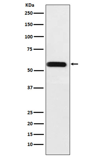 ANGPTL3 (1Z15) Rabbit Monoclonal Antibody | 兔单抗 | EnkiLife恩玑生命