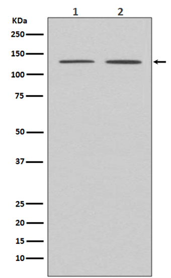 APAF1  (1L2) Rabbit Monoclonal Antibody | 兔单抗 | EnkiLife恩玑生命