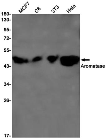 Aromatase (4R11) Rabbit Monoclonal Antibody | 兔单抗 | EnkiLife恩玑生命