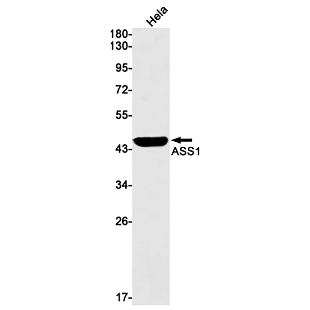 ASS1 (17N16) Rabbit Monoclonal Antibody | 兔单抗 | EnkiLife恩玑生命