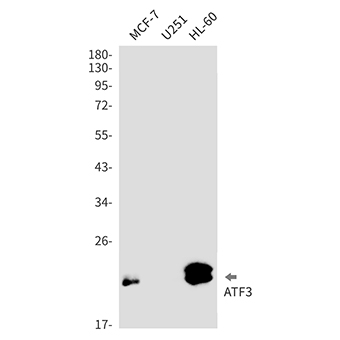 ATF3 (14D8) Rabbit Monoclonal Antibody | 兔单抗 | EnkiLife恩玑生命