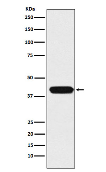 ATOH1 (17T16) Rabbit Monoclonal Antibody | 兔单抗 | EnkiLife恩玑生命