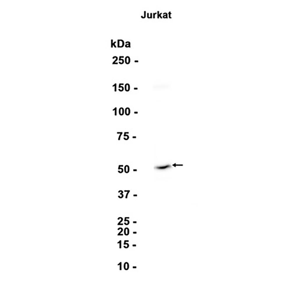 BAF57/SMARCE1 (16D16) Rabbit Monoclonal Antibody | 兔单抗 | EnkiLife恩玑生命