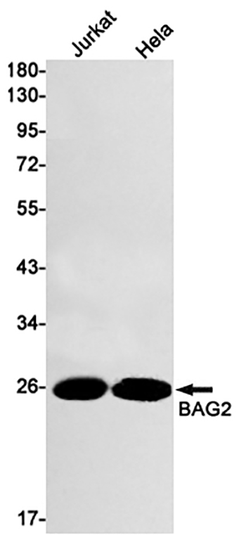 BAG2 (9Z17) Rabbit Monoclonal Antibody | 兔单抗 | EnkiLife恩玑生命