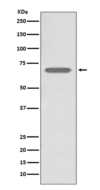 beta 2 Adrenergic Receptor (4E18) Rabbit Monoclonal Antibody | 兔单抗 | EnkiLife恩玑生命