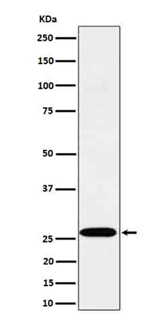 C1QA (17R4) Rabbit Monoclonal Antibody | 兔单抗 | EnkiLife恩玑生命