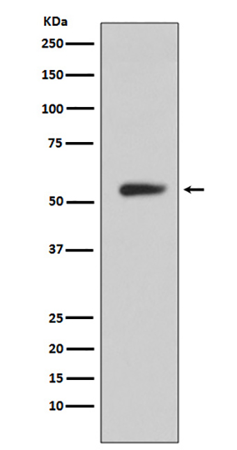 CA9 (14N17) Rabbit Monoclonal Antibody | 兔单抗 | EnkiLife恩玑生命