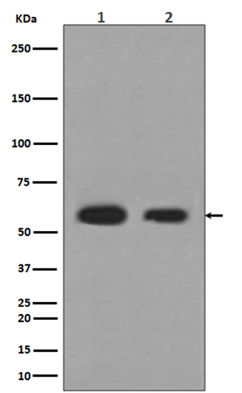 Calreticulin (3B4) Rabbit Monoclonal Antibody | 兔单抗 | EnkiLife恩玑生命
