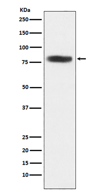 CARS (9E19) Rabbit Monoclonal Antibody | 兔单抗 | EnkiLife恩玑生命