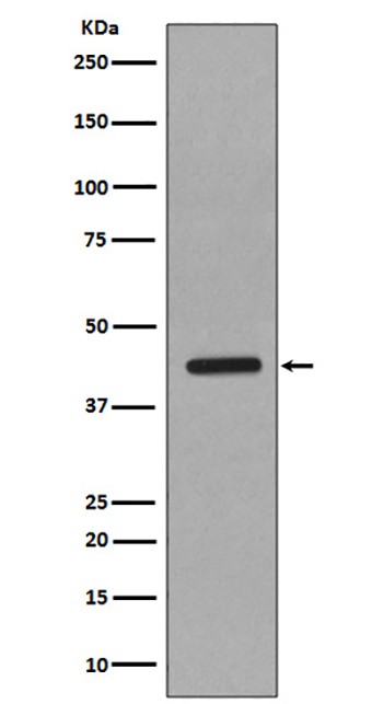 Caspase-1 (16E17) Rabbit Monoclonal Antibody | 兔单抗 | EnkiLife恩玑生命