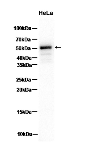 Caspase-1 (16E17) Rabbit Monoclonal Antibody | 兔单抗 | EnkiLife恩玑生命
