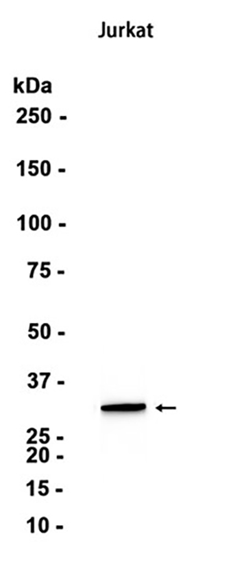 Caspase-6 (13P13) Rabbit Monoclonal Antibody | 兔单抗 | EnkiLife恩玑生命