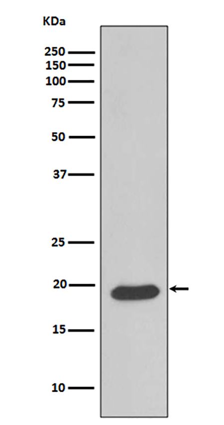 Caveolin-3 (19O1) Rabbit Monoclonal Antibody | 兔单抗 | EnkiLife恩玑生命
