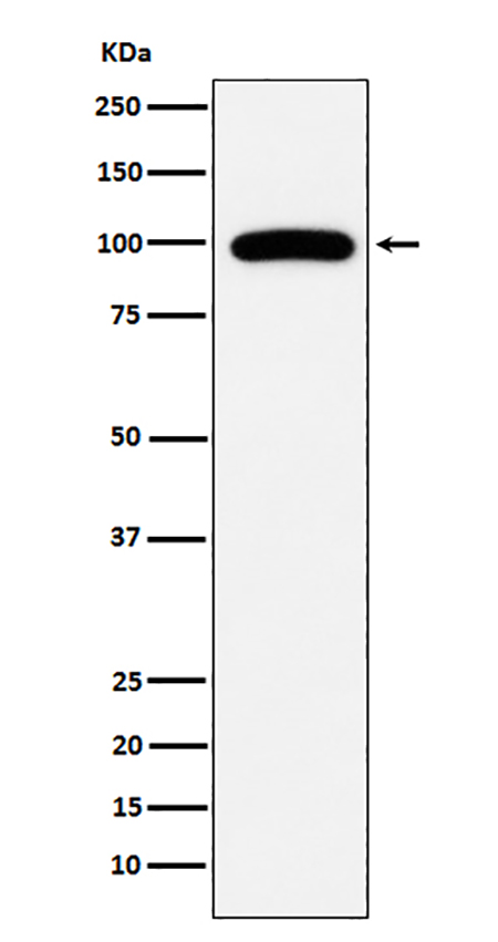 CD10 (15I14) Rabbit Monoclonal Antibody | 兔单抗 | EnkiLife恩玑生命