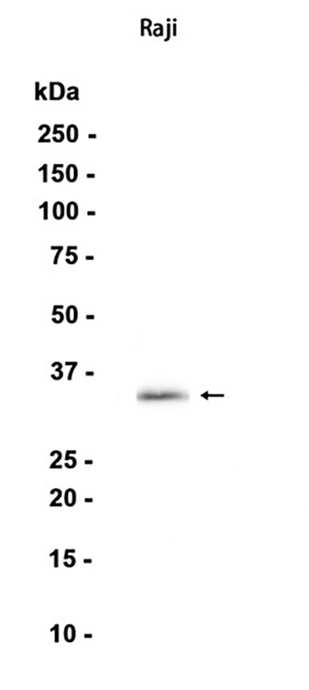 CD20 (18I8) Rabbit Monoclonal Antibody | 兔单抗 | EnkiLife恩玑生命
