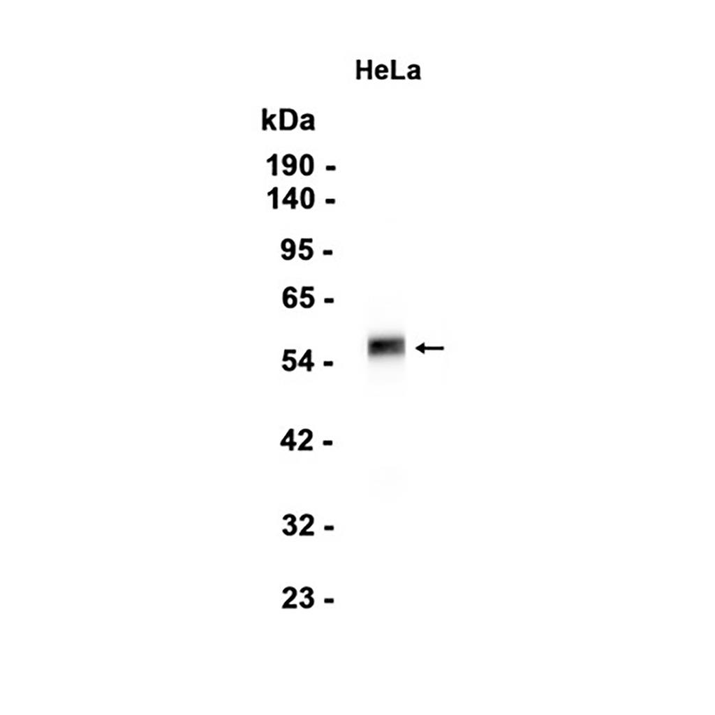 CDK8 (2S1) Rabbit Monoclonal Antibody | 兔单抗 | EnkiLife恩玑生命