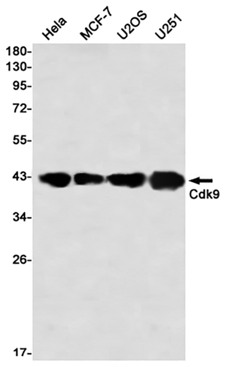 CDK9 (5L11) Rabbit Monoclonal Antibody | 兔单抗 | EnkiLife恩玑生命