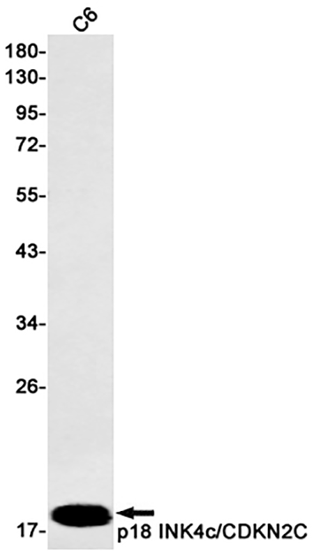 CDKN2C (10M18) Rabbit Monoclonal Antibody | 兔单抗 | EnkiLife恩玑生命