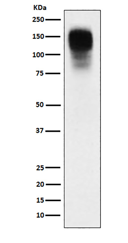 CEACAM1 (1W1) Rabbit Monoclonal Antibody | 兔单抗 | EnkiLife恩玑生命
