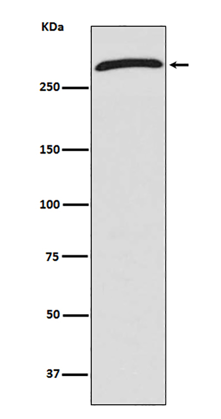 CHD4 (15O2) Rabbit Monoclonal Antibody | 兔单抗 | EnkiLife恩玑生命