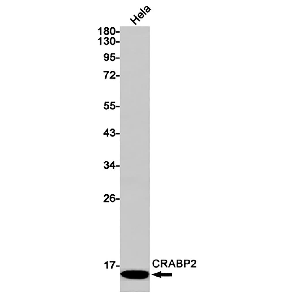CRABP2 (12M4) Rabbit Monoclonal Antibody | 兔单抗 | EnkiLife恩玑生命