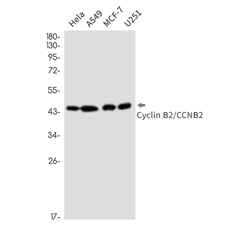Cyclin B2 (18U13) Rabbit Monoclonal Antibody | 兔单抗 | EnkiLife恩玑生命