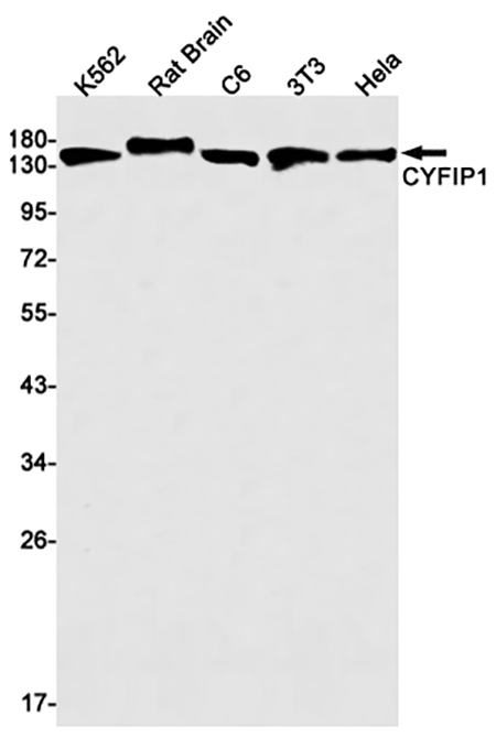 CYFIP1 (15Y6) Rabbit Monoclonal Antibody | 兔单抗 | EnkiLife恩玑生命
