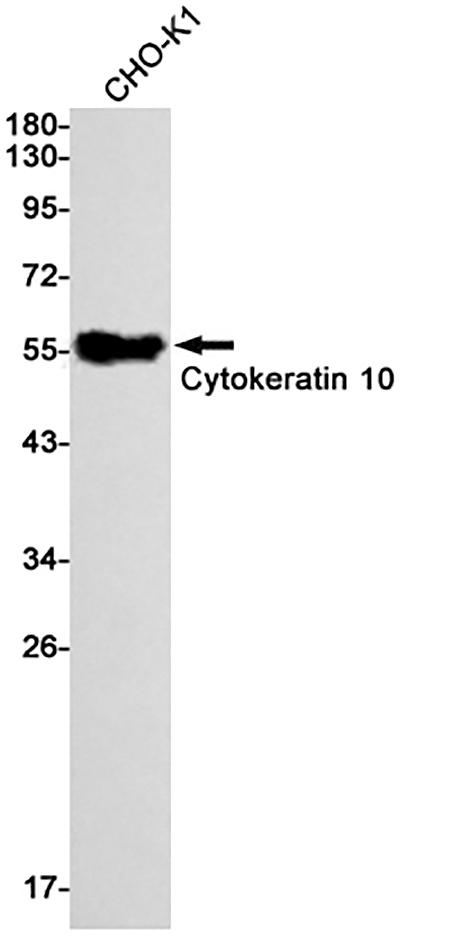 Cytokeratin 10 (7W9) Rabbit Monoclonal Antibody | 兔单抗 | EnkiLife恩玑生命