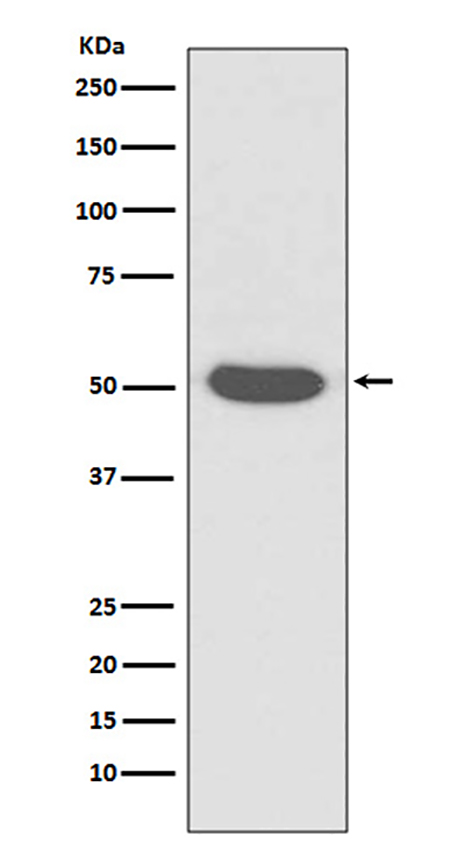 Cytokeratin 14 (11A9) Rabbit Monoclonal Antibody | 兔单抗 | EnkiLife恩玑生命