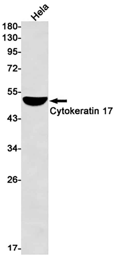 Cytokeratin 17 (9F13) Rabbit Monoclonal Antibody | 兔单抗 | EnkiLife恩玑生命