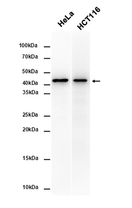 Cytokeratin 18 (6Y2) Rabbit Monoclonal Antibody | 兔单抗 | EnkiLife恩玑生命
