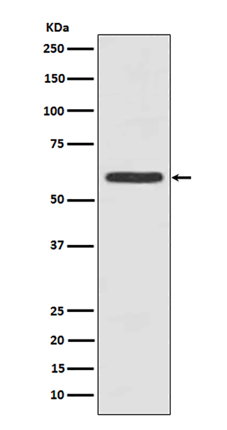 Cytokeratin 5 (C-term) (15B6) Rabbit Monoclonal Antibody | 兔单抗 | EnkiLife恩玑生命