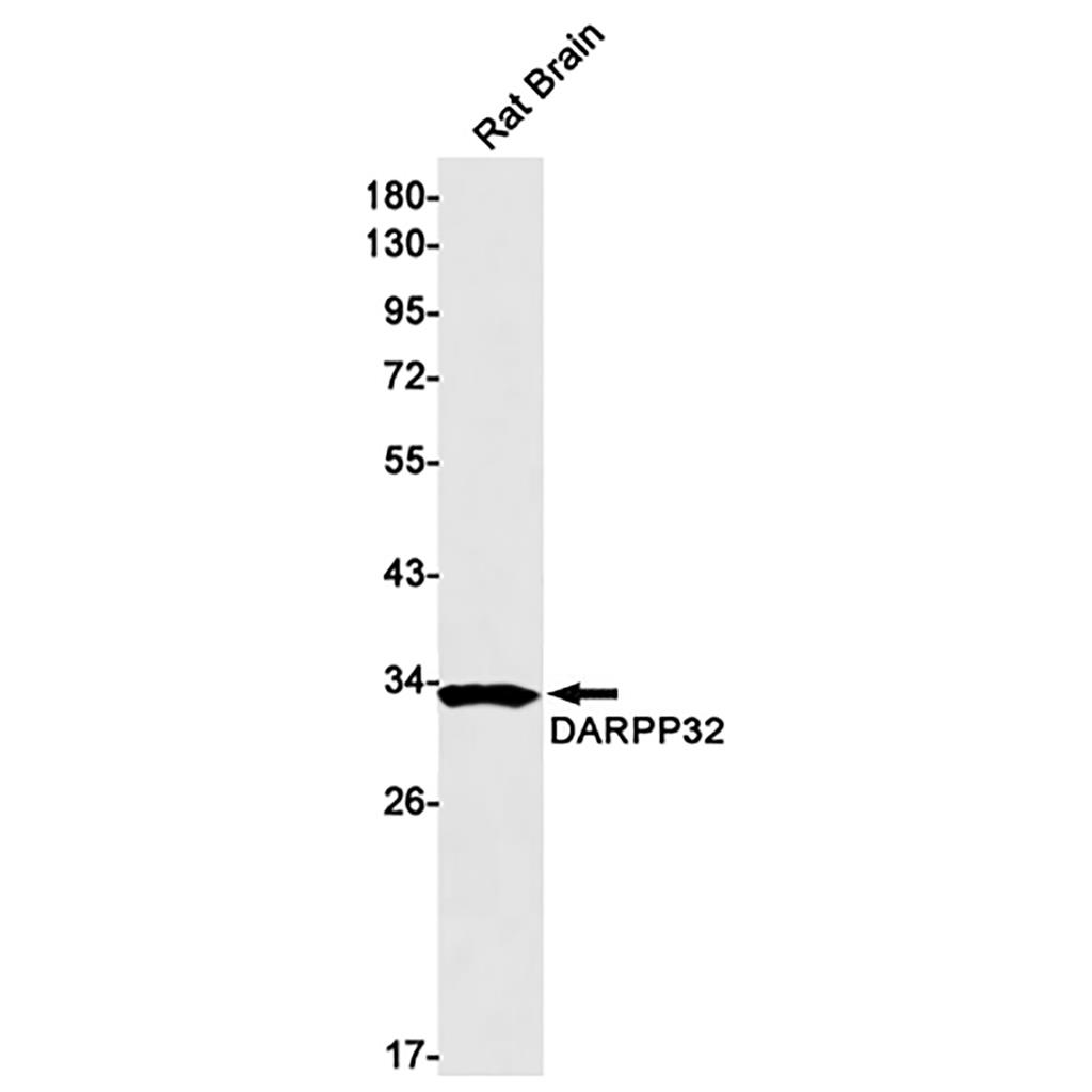 DARPP32 (18W7) Rabbit Monoclonal Antibody | 兔单抗 | EnkiLife恩玑生命