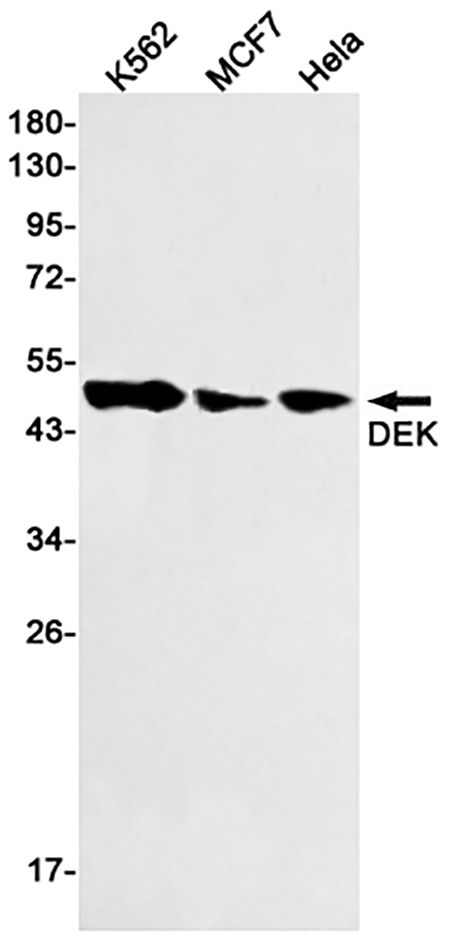 DEK (19H13) Rabbit Monoclonal Antibody | 兔单抗 | EnkiLife恩玑生命