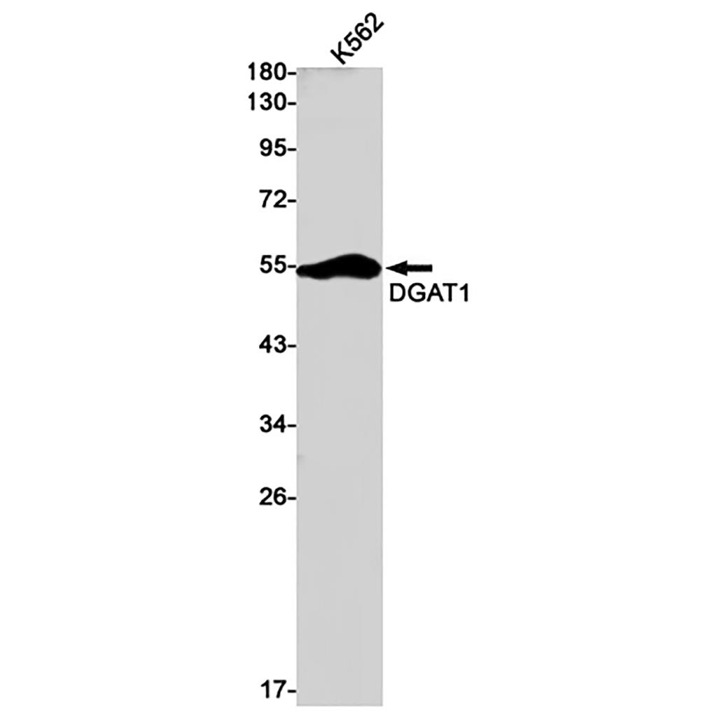 DGAT1 (12C4) Rabbit Monoclonal Antibody | 兔单抗 | EnkiLife恩玑生命