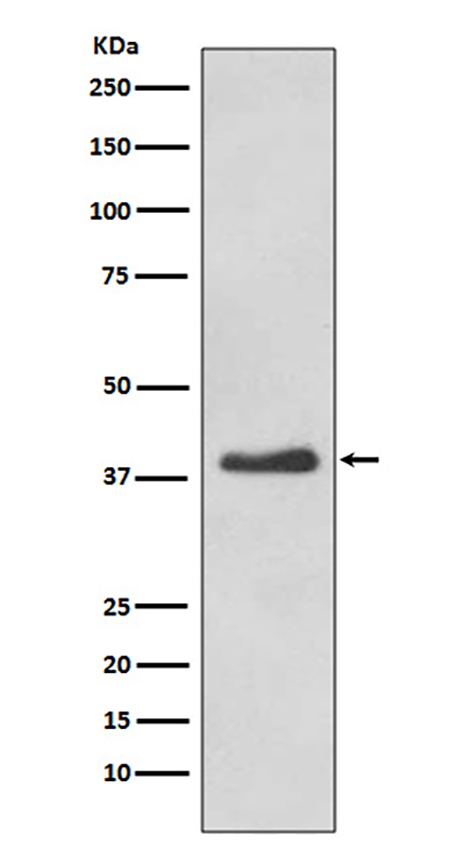 DKK1 (7G7) Rabbit Monoclonal Antibody | 兔单抗 | EnkiLife恩玑生命