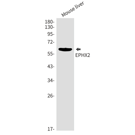 EPHX2 (4Q4) Rabbit Monoclonal Antibody | 兔单抗 | EnkiLife恩玑生命