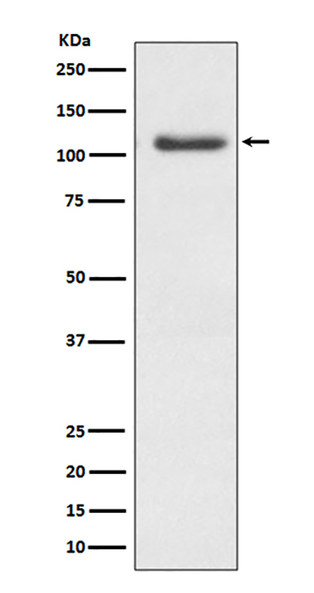 ERK5 (1Z9) Rabbit Monoclonal Antibody | 兔单抗 | EnkiLife恩玑生命